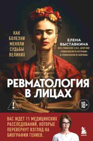revmatologiya-v-licah-kak-bolezni-menyali-sudby-velikih